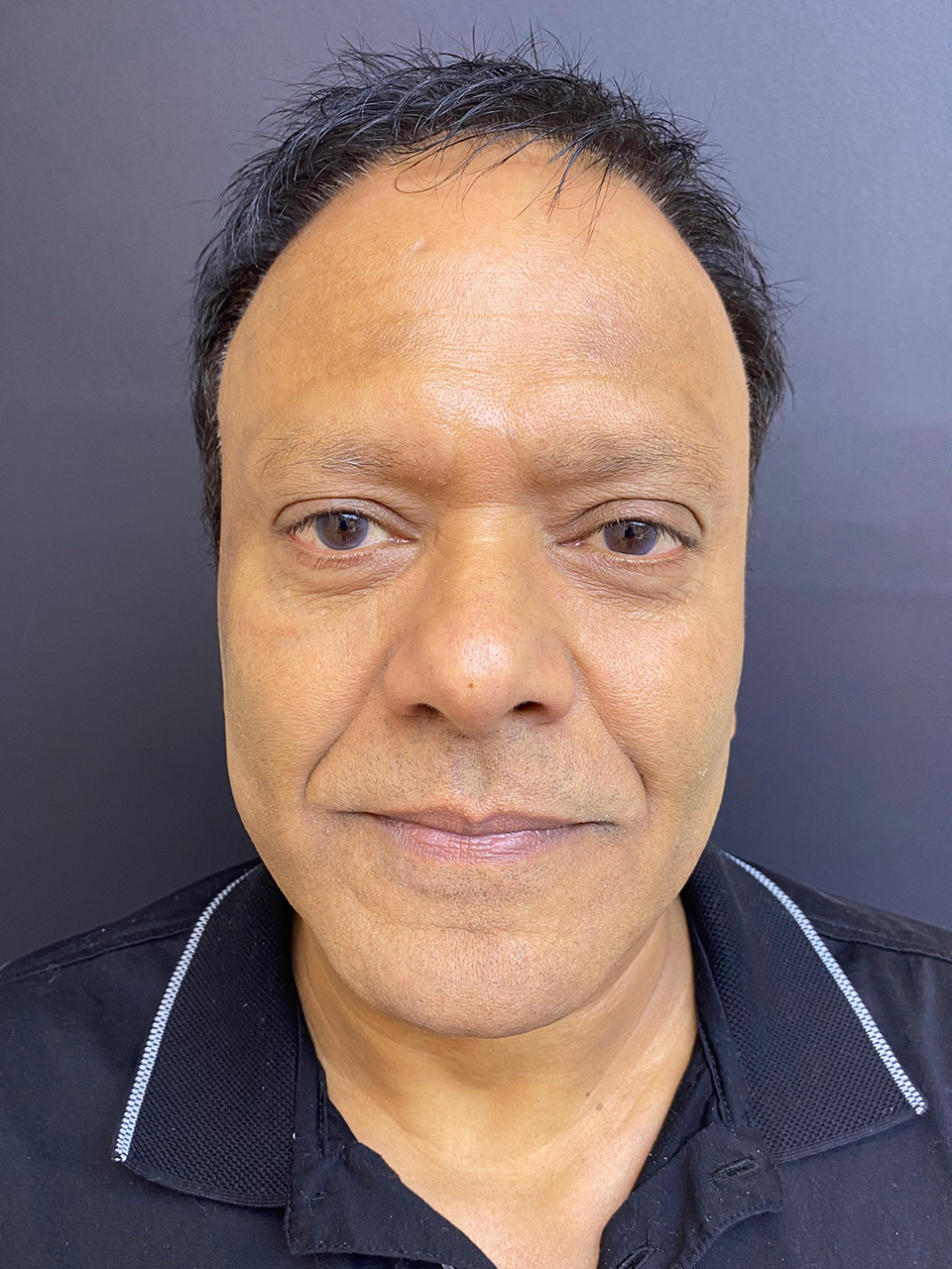 After treatment
